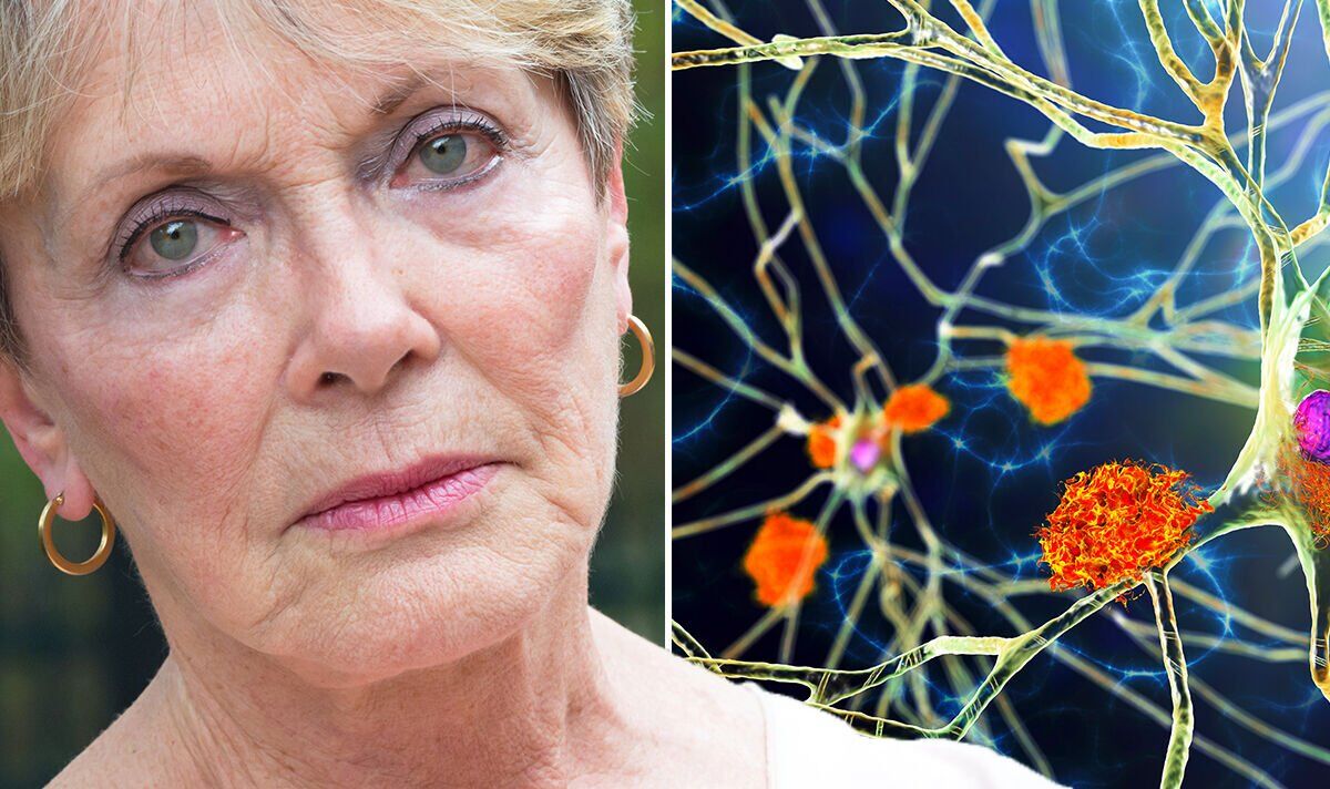 Naisten Alzheimerin taudin riskin ja omega-3-rasvahappojen välinen yhteys on havaittu
